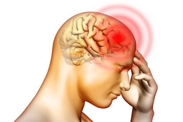 Những nguyên nhân gây đau đầu kéo dài thường gặp
