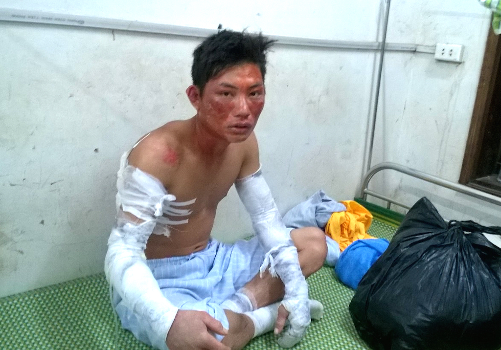 Anh Vi Khắc Nhớ bị thương nặng sau vụ nổ kinh hoàng và đang được điều trị tại Bệnh viện đa khoa Tây Bắc Nghệ An