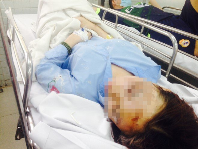 Nữ sinh bị tạt axit ở Sài Gòn: Nghi bạn từng ở cùng phòng