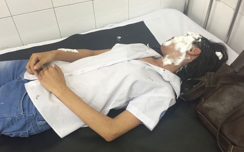 Hai nữ sinh bị tạt axit nguy hiểm tại TP Hồ Chí Minh do ghen tuông