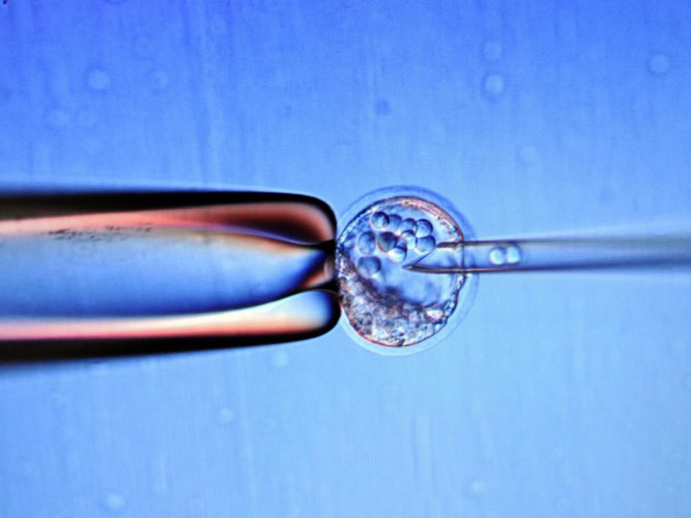 Tế bào phôi gốc để thực hiện phát minh mới. Ảnh AFP/Getty