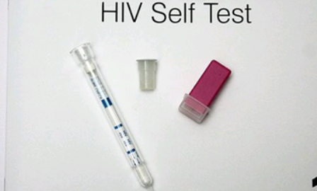 Phát minh mới - bộ dụng cụ chẩn đoán chính xác HIV chỉ trong 15 phút