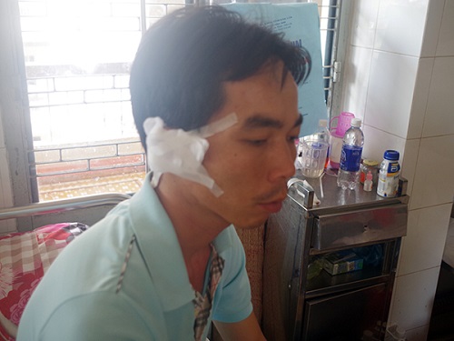 Phó công an xã Vương Đức Luận đang được điều trị tại bệnh viện đa khoa tỉnh Đắk Lắk