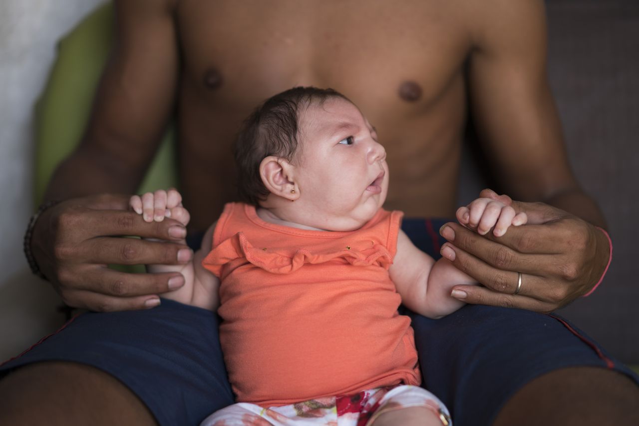 Virus Zika đang bị nghi ngờ là nguyên nhân gây hội chứng đầu nhỏ ở trẻ sơ sinh