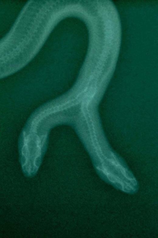 Chú rắn Medusa có hai đầu tách biệt 
