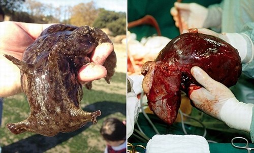 Con sên biển (bên trái) có thân hình khá giống với lá gan con người (bên phải)