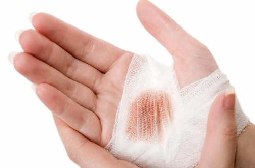 Cách sơ cứu vết thương hiệu quả, nhanh chóng