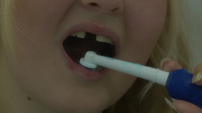 Linzi Grant chải răng thường xuyên nhưng răng vẫn rụng. Ảnh: ITV News Anglia