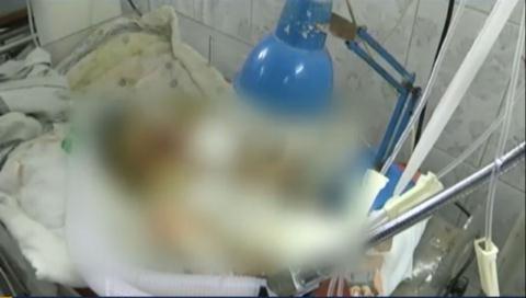 Hình ảnh bé sơ sinh 10 ngày tuổi đang chữa trị trong bệnh viện trước ngày tai nạn hy hữu xảy ra