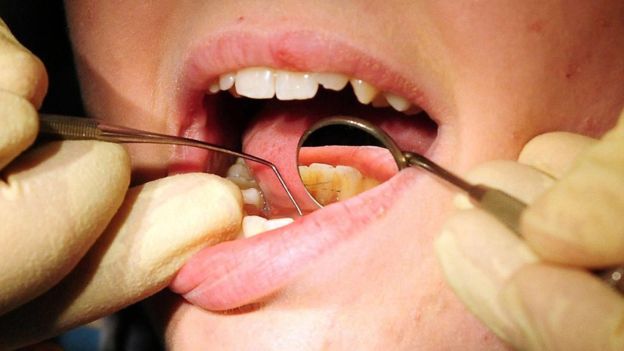 một số sản phẩm tẩy trắng răng chứa natri perborate. Hóa chất này bị cấm sử dụng trong sản phẩm mỹ phẩm của EU trong đó nói rằng nó có thể gây vô sinh và bất thường của thai nhi.