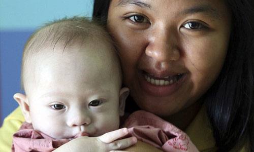 Người phụ nữ Thái Lan mang thai hộ vợ chồng người Australia, cùng cậu con trai bị bệnh. Ảnh: AP