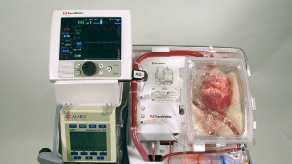  Thiết bị chăm sóc nội tạng (OCS) giúp phục hồi chức năng quả tim trước khi thực hiện cấy ghép tim