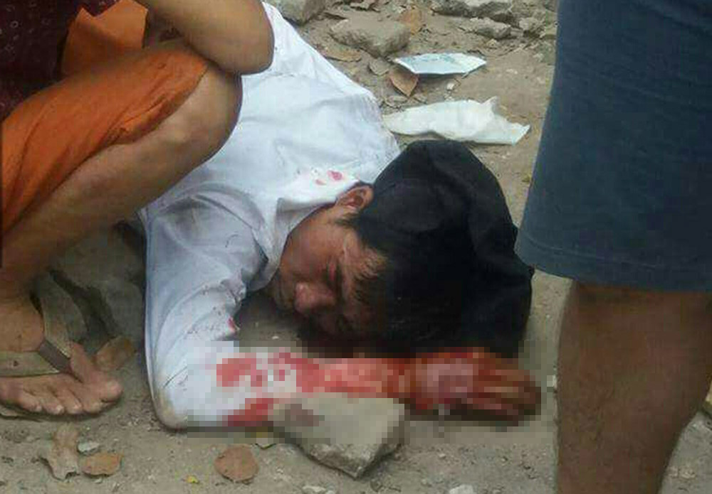 Những tin pháp luật online mới nhất hôm nay đề cập đến vụ người đàn ông bị đánh suýt chết ở gần đền Lừ