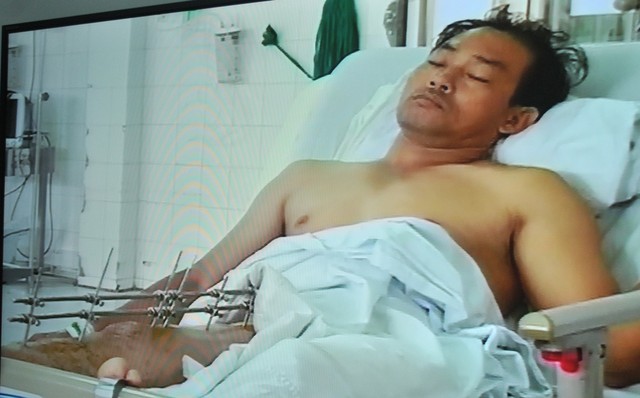 Nguyễn Hùng Cường, một trong số những người bị thương, đang được điều trị trong bệnh viện