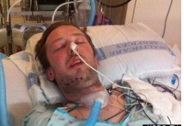 Dustin Theoharis nằm hôn mê tại bệnh viện sau khi bị cảnh sát bắn nhầm, theoo tin tức mới nhất. Ảnh Mirror