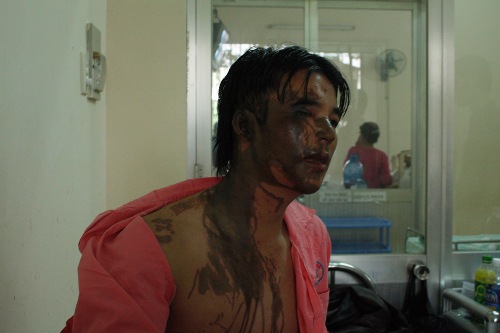 Trong những tin tức pháp luật 24h qua có vụ 2 vợ chồng bị tạt axit trong đêm ở Gò Vấp, TPHCM Trong những tin tức pháp luật 24h qua có vụ 2 vợ chồng bị tạt axit trong đêm ở Gò Vấp, TPHCM