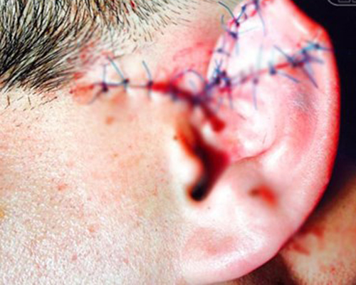 Nhậu say gây hậu quả nghiêm trọng là tin tức pháp luật mới nhất hôm nay