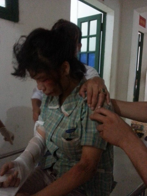 Nữ công nhân bị cướp giật điện thoại theo những tin tức pháp luật online mới nhất trong ngày. Ảnh: 