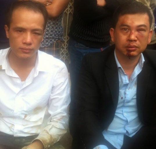 Hình ảnh hai luật sư Trần Thu Nam và Lê Văn Luân bị đánh trên trang Facebook cá nhân của họ