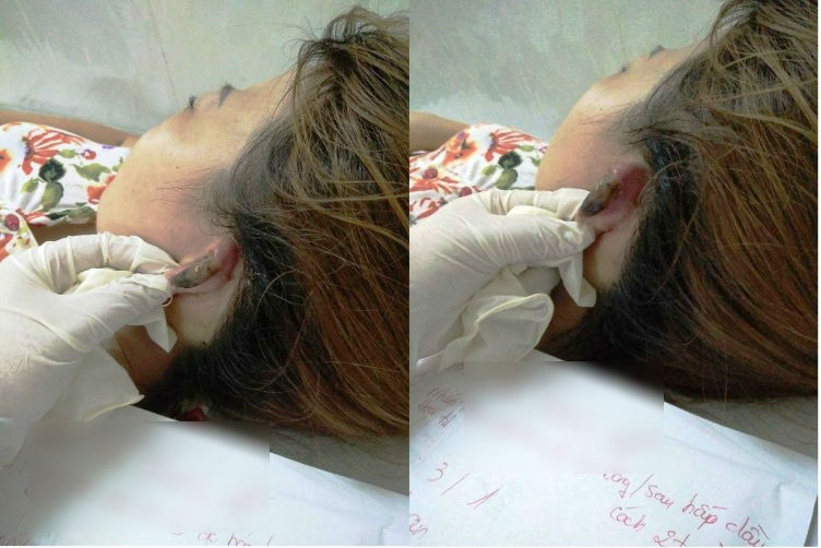 Hấp tóc đón tết:  Ẩn họa siêu độc