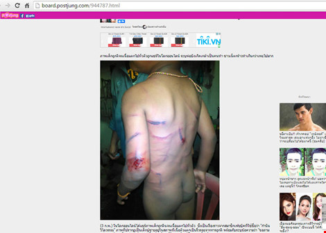 Hình ảnh về tin đồn trẻ bị bạo hành được cho là lấy từ nguồn Thái Lan và bị dựng chuyện để câu kéo dư luận