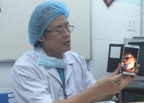 Bác sĩ Nguyễn Văn Đẩu chia sẻ về trường hợp trẻ em bị chó cắn rách mặt gần đây nhất