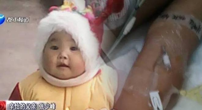 bé gái Tân Di, 2 tuổi ở thành phố Lạc Dương, tỉnh Hà Nam (Trung Quốc) bị hôn mê sâu suốt 2 tuần qua do bị tổn thương não.