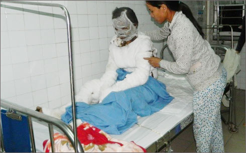 Tự thiêu vì bị chồng bạo hành, thai phụ đã tử vong do vết thương quá nặng