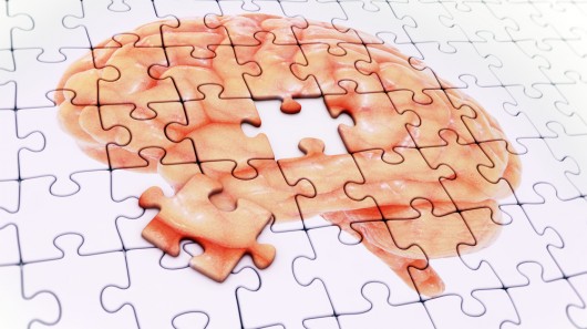 Tin khoa học mới giúp tìm ra phương pháp điều trị bệnh Alzheimer hiệu quả
