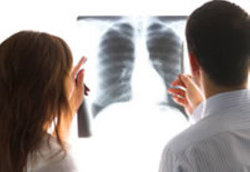 Ung thư phổi là căn bệnh gây tử vong hàng đầu