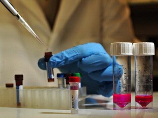 Các nhà khoa học Đan Mạch đã tìm ra cách tách vi rút HIV khỏi ADN của người, từ đó cho phép hệ miễn dịch tiêu diệt vi rút này - Ảnh: AFP