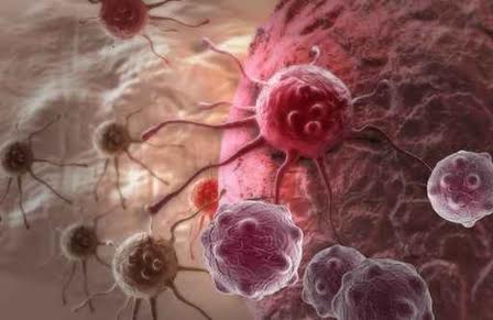 Ký sinh trùng mắc ung thư gây u bướu ở người