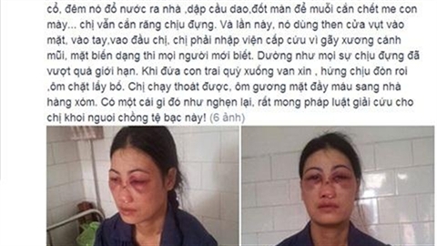 Chồng bắt vợ ăn phân lợn ở Nam Định 1
