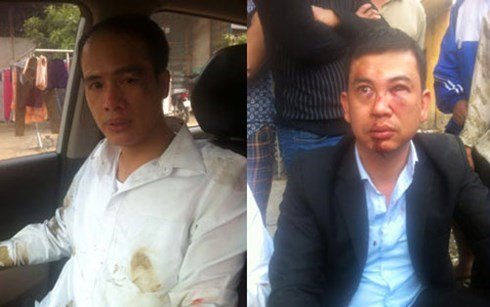 Công an Hà Nội đã quyết định khởi tố điều tra vụ 2 luật sư bị đánh tại huyện Chương Mỹ vào ngày 3/11