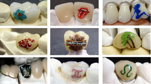Trào lưu xăm răng: Những hình thù khác nhau được xăm lên răng