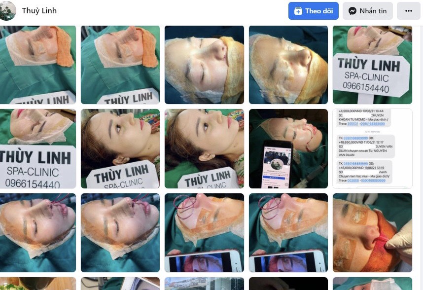 Cẩn trọng với bác sĩ Thùy Linh trên facebook: Thẩm mỹ hỏng rồi ‘phủi tay’?