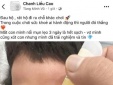 Trào lưu nhỏ nước chanh vào mắt để thải độc: Chuyên gia lên tiếng