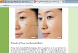 Phòng khám Dermatol Master thẩm mỹ bằng axit?