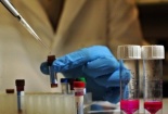 Sẽ có thuốc chữa HIV trong vài tháng tới?