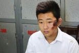 Rúng động phát hiện lời khai man trá bảo vệ giúp phi tang xác vụ thẩm mỹ viện