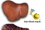 Nước giải rượu Picoman: Quảng cáo gây hiểu lầm!