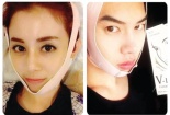 'Méo mặt' vì ... thẩm mỹ V-line