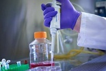 Tách được các virus HIV khỏi tế bào người
