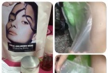 Tổn thương da vì dùng kem thay da collagen