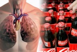 Nguy hại không ngờ từ Coca – Cola