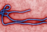 Vì sao virus Ebola nguy hiểm