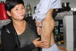 Khởi tố vụ hai chú tiểu bị đánh đập dã man