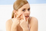 Lưu ý lựa chọn kem dưỡng ẩm cho da mụn