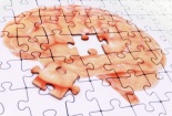 Lý giải các triệu chứng bệnh Alzheimer trên chuột thí nghiệm 