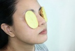 Mẹo làm dịu vết cháy nắng mùa hè từ khoai tây
